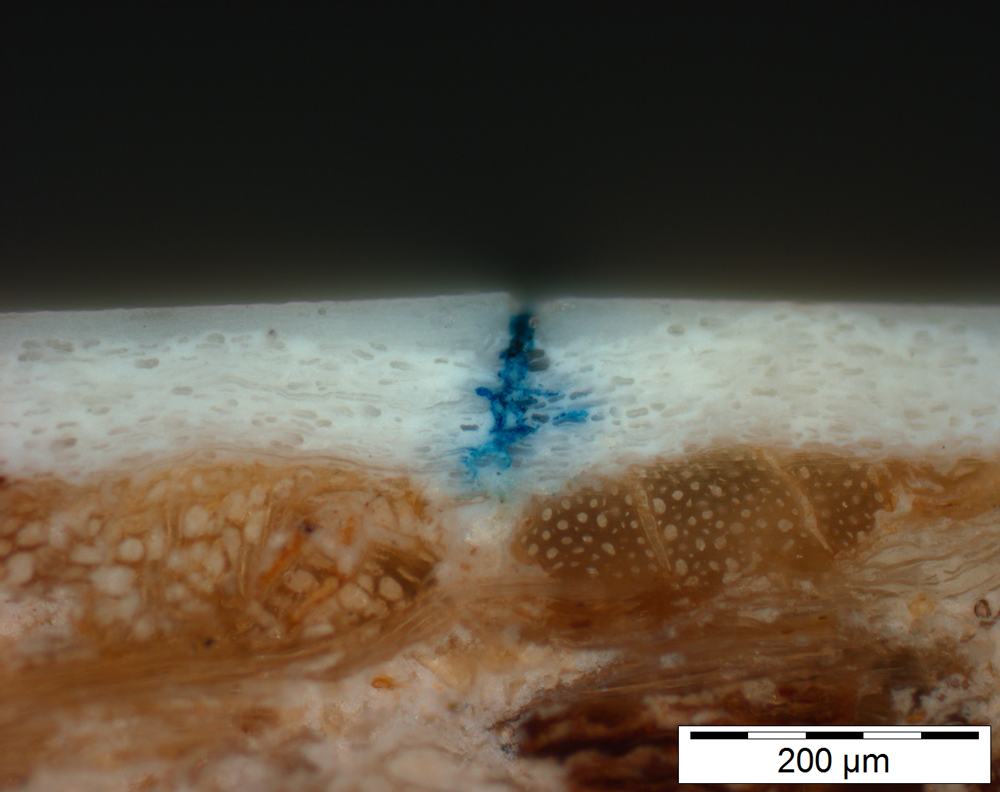 Mikroskopbild zeigt zellartige, bräunliche Struktur, die von einer zellartigen, weißen Struktur bedeckt ist. In der weißen Schicht ist ein schmaler, blauer Bereich, der von ganz oben bis zu bräunlichen Schicht reicht. Am oberen Ende der blauen Verfärbung wölbt sich die weiße Schicht kraterartig nach oben.
